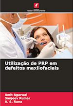 Utilização de PRP em defeitos maxilofaciais