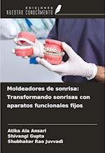 Moldeadores de sonrisa: Transformando sonrisas con aparatos funcionales fijos