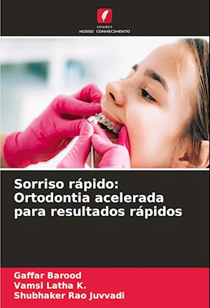 Sorriso rápido: Ortodontia acelerada para resultados rápidos