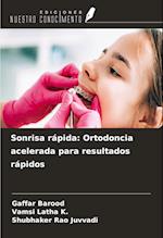 Sonrisa rápida: Ortodoncia acelerada para resultados rápidos