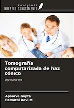 Tomografía computarizada de haz cónico