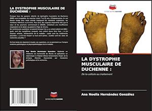 LA DYSTROPHIE MUSCULAIRE DE DUCHENNE :