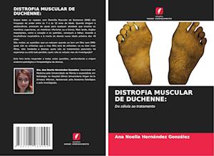 DISTROFIA MUSCULAR DE DUCHENNE: