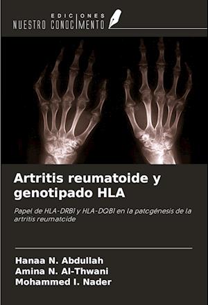 Artritis reumatoide y genotipado HLA