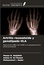 Artritis reumatoide y genotipado HLA