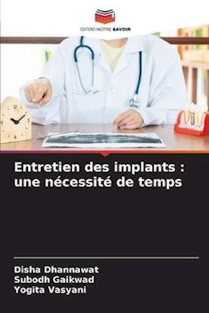 Entretien des implants : une nécessité de temps