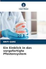 Ein Einblick in das vorgefertigte Pfostensystem