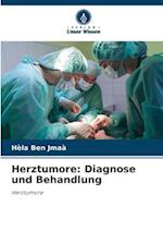 Herztumore: Diagnose und Behandlung