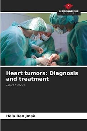 Heart tumors: Diagnosis and treatment