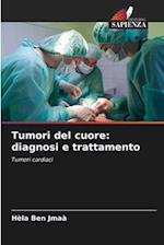 Tumori del cuore: diagnosi e trattamento