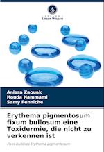 Erythema pigmentosum fixum bullosum eine Toxidermie, die nicht zu verkennen ist