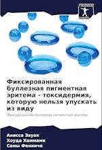 Fixirowannaq bulleznaq pigmentnaq äritema - toxidermiq, kotoruü nel'zq upuskat' iz widu