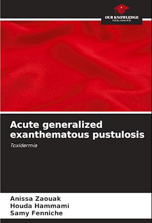 Acute generalized exanthematous pustulosis