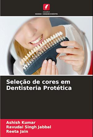 Seleção de cores em Dentisteria Protética