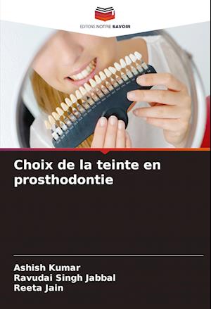 Choix de la teinte en prosthodontie