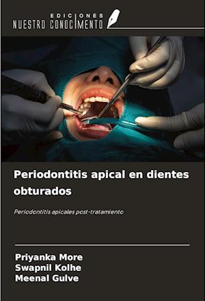 Periodontitis apical en dientes obturados