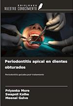 Periodontitis apical en dientes obturados