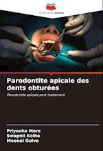 Parodontite apicale des dents obturées