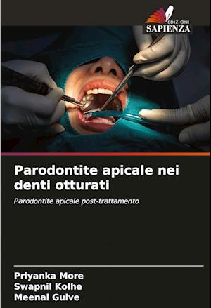 Parodontite apicale nei denti otturati