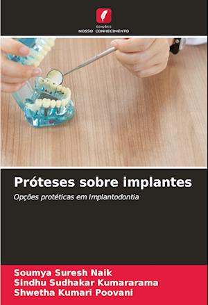 Próteses sobre implantes