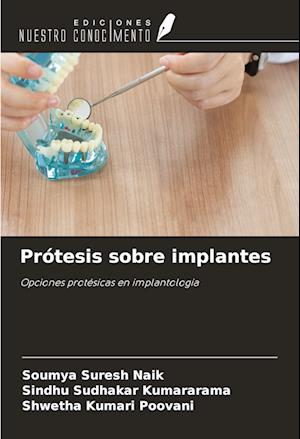 Prótesis sobre implantes