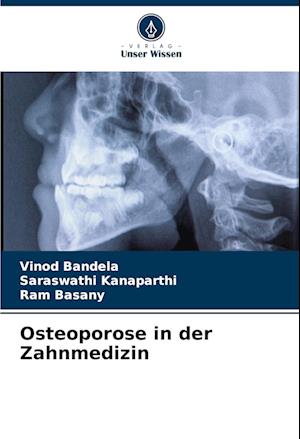 Osteoporose in der Zahnmedizin