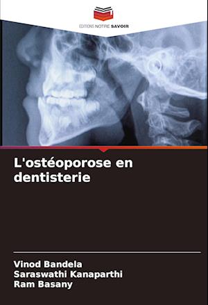 L'ostéoporose en dentisterie