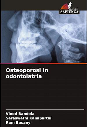 Osteoporosi in odontoiatria