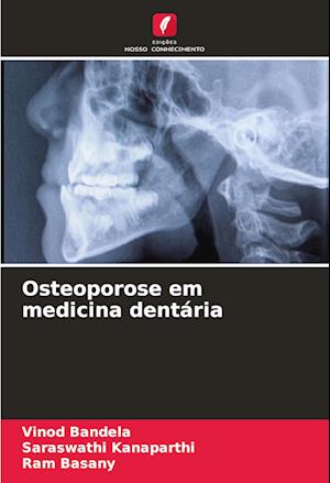 Osteoporose em medicina dentária