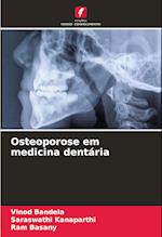 Osteoporose em medicina dentária