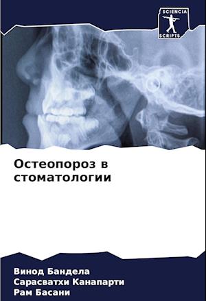 Osteoporoz w stomatologii