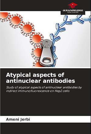 Atypical aspects of antinuclear antibodies