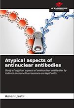 Atypical aspects of antinuclear antibodies