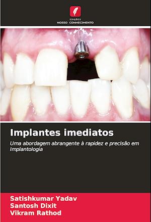 Implantes imediatos