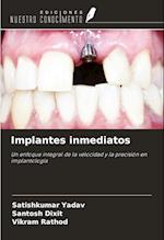 Implantes inmediatos