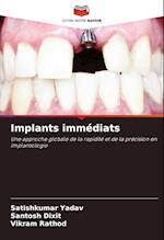 Implants immédiats