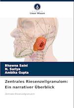 Zentrales Riesenzellgranulom: Ein narrativer Überblick