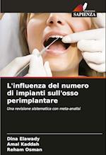 L'influenza del numero di impianti sull'osso perimplantare