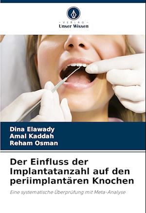 Der Einfluss der Implantatanzahl auf den periimplantären Knochen