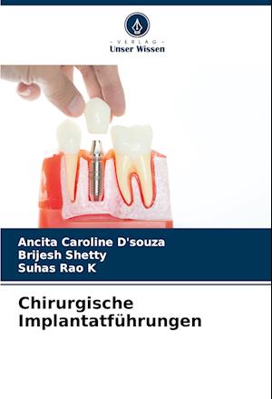 Chirurgische Implantatführungen