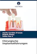 Chirurgische Implantatführungen