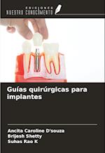 Guías quirúrgicas para implantes