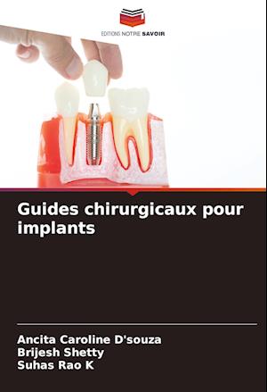 Guides chirurgicaux pour implants