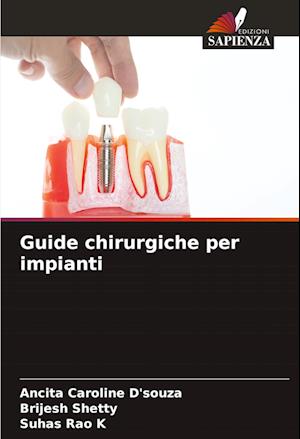 Guide chirurgiche per impianti