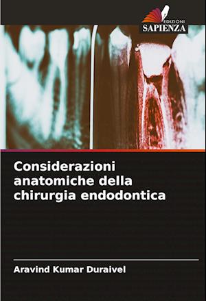 Considerazioni anatomiche della chirurgia endodontica