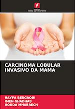 CARCINOMA LOBULAR INVASIVO DA MAMA