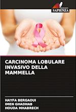 CARCINOMA LOBULARE INVASIVO DELLA MAMMELLA