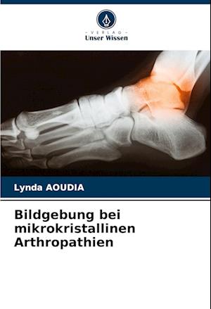 Bildgebung bei mikrokristallinen Arthropathien