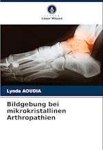 Bildgebung bei mikrokristallinen Arthropathien