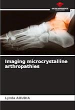 Imaging microcrystalline arthropathies